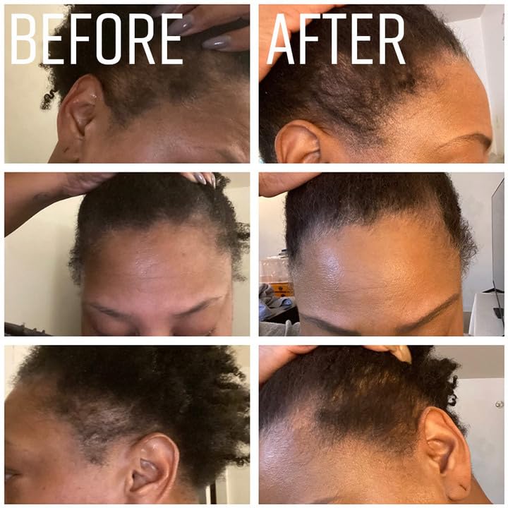 4oz Organic Cold Pressed Jamaican Black Castor Oil for Hair Growth and Damaged, Dry Scalp - Unscented, Hexane-Free IQNATURAL